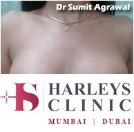 Breast Enlargement Surgery