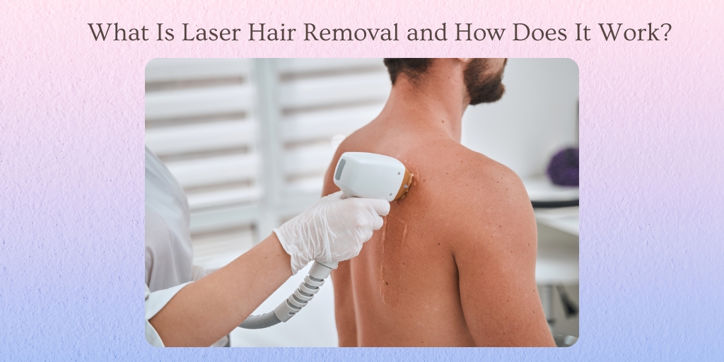 What Is Laser Hair Removal and How Does It Work?