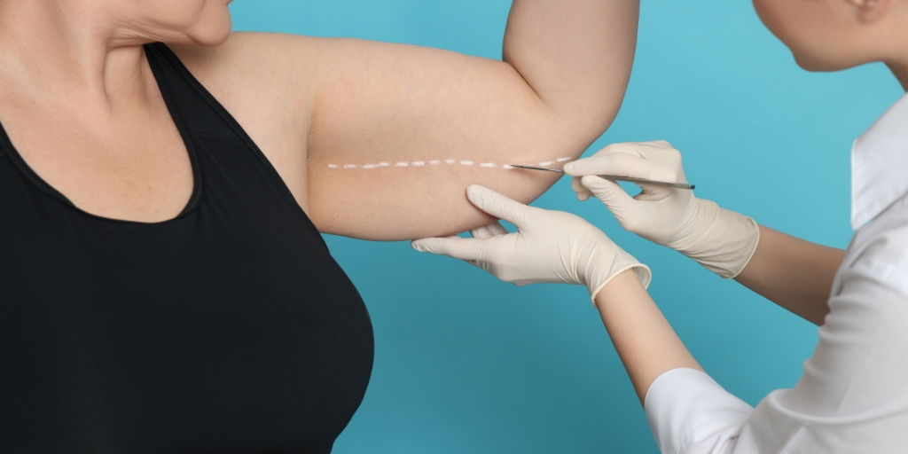 Arm Liposuction treatment in mumbai