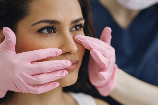 Blepharoplasty Eyebags